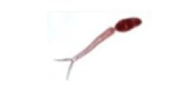 <ul><li><p>cercaria belonging to schistosoma </p></li><li><p>causes schistosomiasis (snail fever)</p></li></ul><p></p>