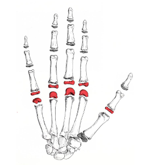 <p>What is this joint?</p>