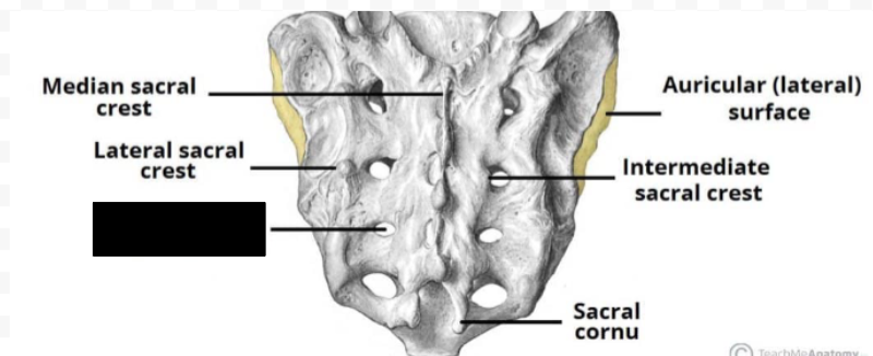 <p>What part of coccyx is this?</p>