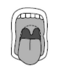 <p>what mallampti score </p>