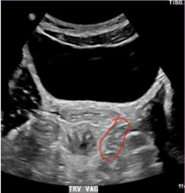 <p>What muscle is this?</p>