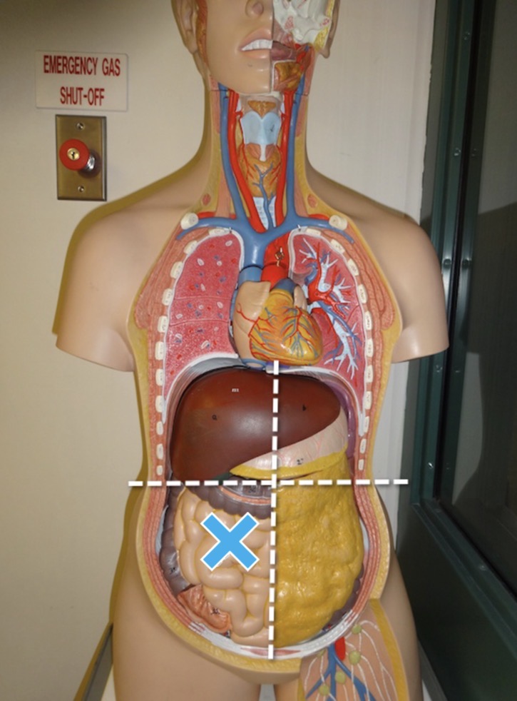 <p>Name the abdominopelvic quadrant the mark is in</p>