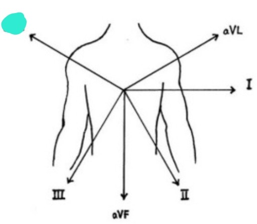 <p>right arm &amp; left arm/leg 흘러가는 전기적 흐름 보여줌</p>