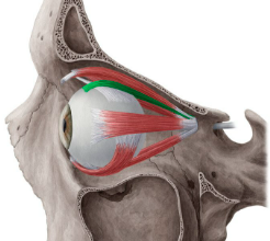 <p>What muscle is in green</p>