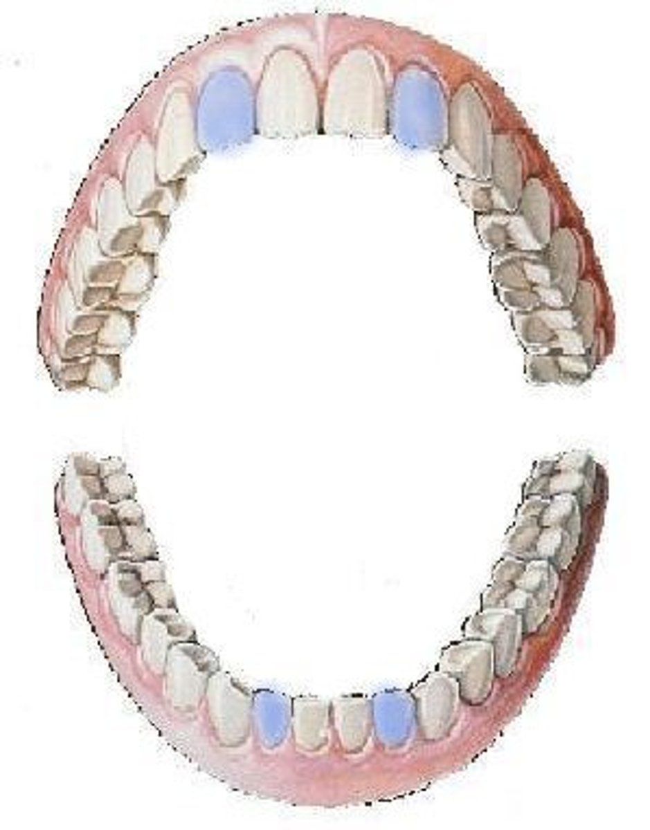 <p>lateral incisors</p>