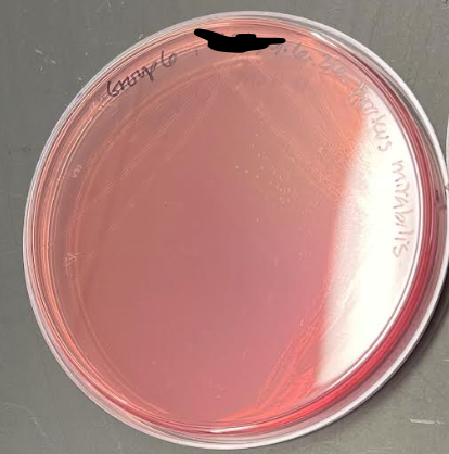<p>What is the plate’s name, selective agent, selects for, differential agents, differentiates between, and everything about it?</p>