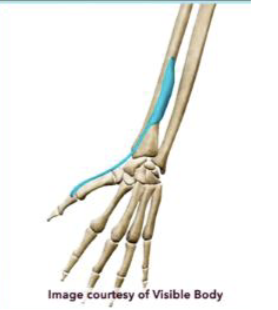 <p>what muscle and action is this </p>