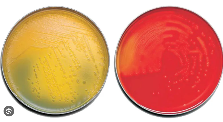 <p>non-selective and non-differential</p><p>BUT</p><p>Blood Agar is a type of this agar that is - non-selective, differential, and enriched</p>