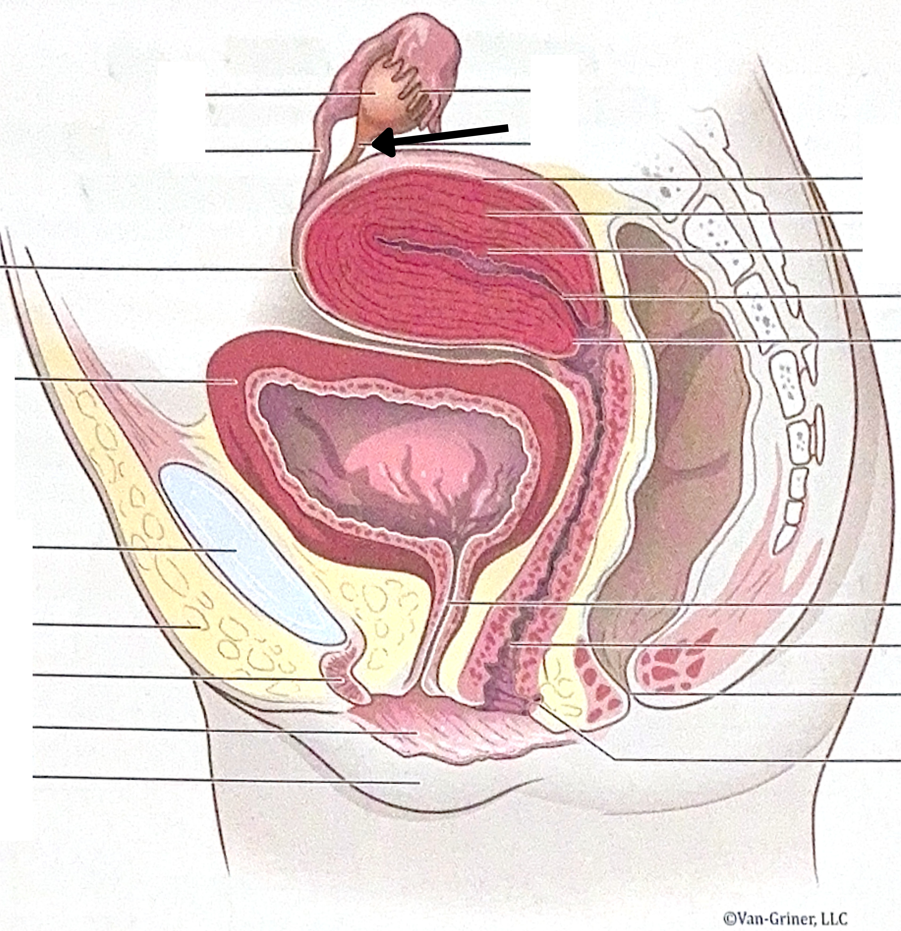 <p>What is the structure indicated in the image?</p>