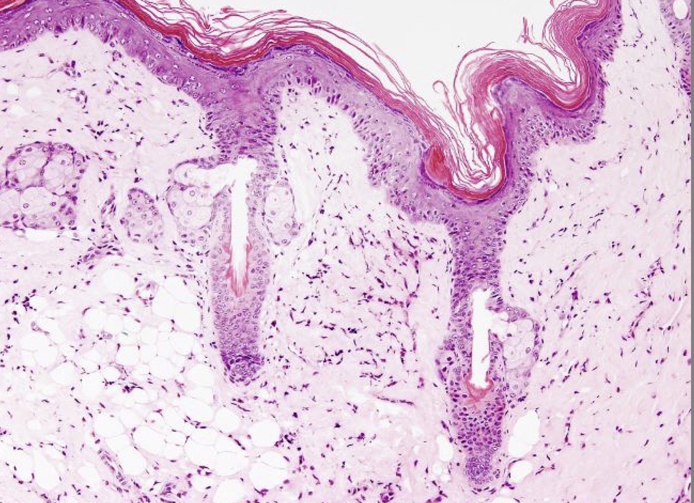 <p>Features of Dermis?</p>