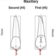 <p>In maxillary first premolars, is the buccal cusp tip distal or mesial to the mid root axis?</p>