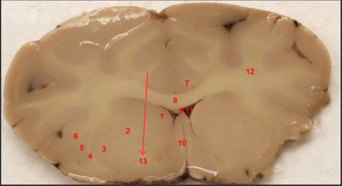 <p>what nuclei is this? </p>