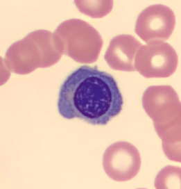 <p>nRBC or lymph?</p>