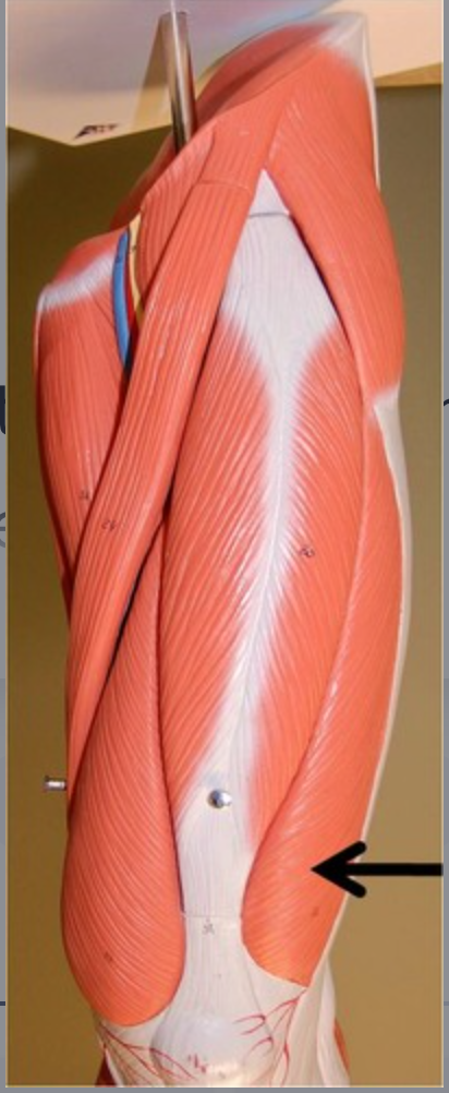 <p>origin: intertrochanteric line insertion: tibial tuberosity (lateral condyle)</p>