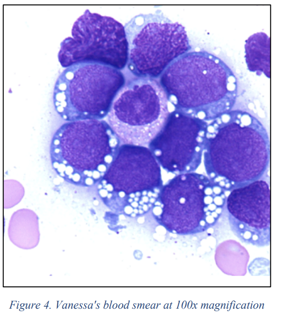 <p>what blood cells are present</p>