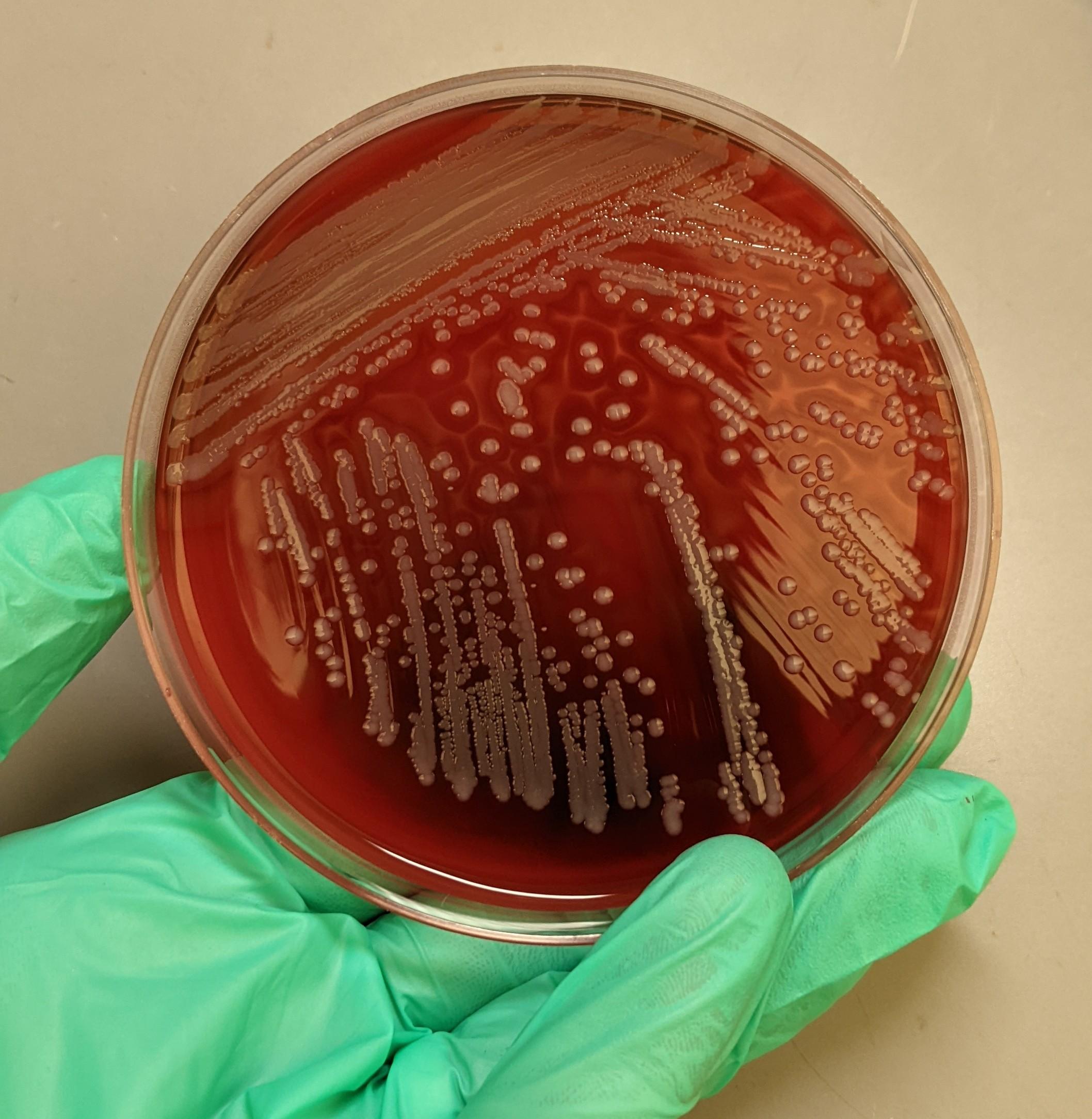 <ul><li><p>white-yellow, raised, or creamy colonies with a smooth surface</p></li><li><p>medium to large</p></li><li><p>narrow zone of <strong>beta hemolysis</strong></p></li></ul><p></p>