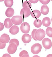 <p><span>no nucleus present RED BLOOD CELLS OR RBCs</span></p>