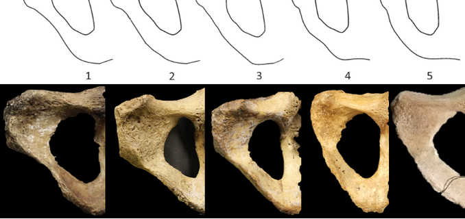 <p>the shape of ischiopubic ramus; In females it has a large concavity, while males have a have convex orientations</p>