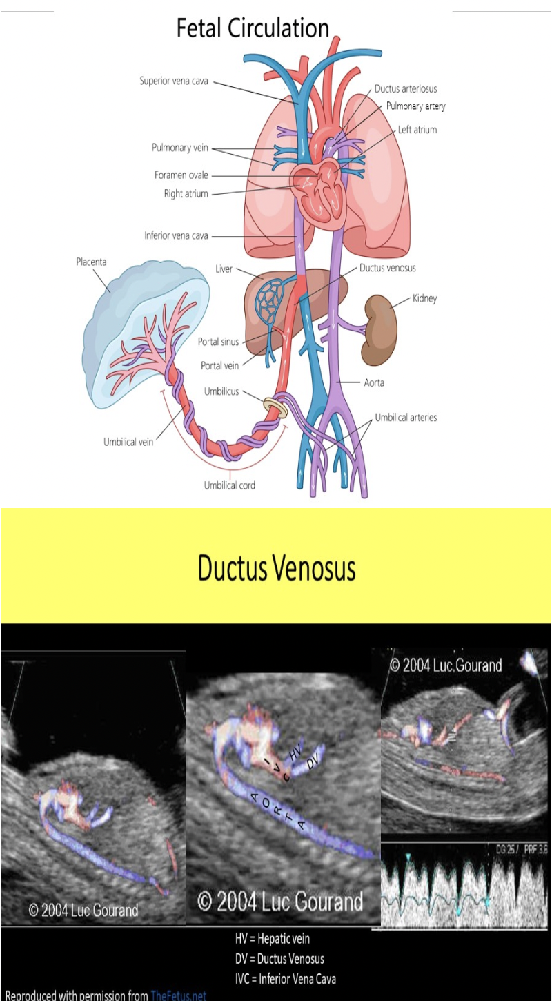 <p>C. ductus venosus</p><p>The foramen ovale describes the opening in the interatrial septum that allows normal shunting between the atria. It functions to as a shunt for the fetal flow to bypass the fetal lungs. The foramen ovale normally closes very soon after birth. The ductus arteriosus describes the connecting vessel from the main pulmonary trunk to the descending aorta in fetal circulation. It functions as a shunt to bypass the fetal lungs. The ductus venosus describes the vessel that shunts blood flow around the fetal liver in fetal circulation. Both ductus connections also close shortly after birth.</p>