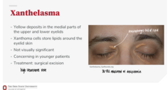 <p>What is the treatment for xanthelasma?</p>