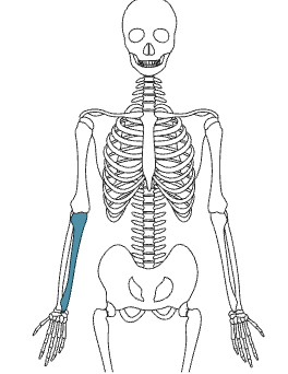 <p>What bone is this?</p>
