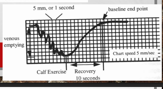 <p>what does this tracing above represents?</p>