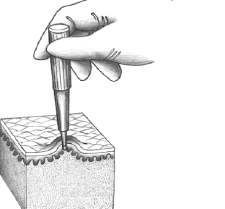 <ul><li><p>the process of taking a sample of living tissue for histopathologic examination</p></li><li><p><strong>gold standard for definitive diagnosis</strong></p></li><li><p>tissue specimen is process into glass slides and histologic features are evaluated microscopically</p></li></ul><p></p>
