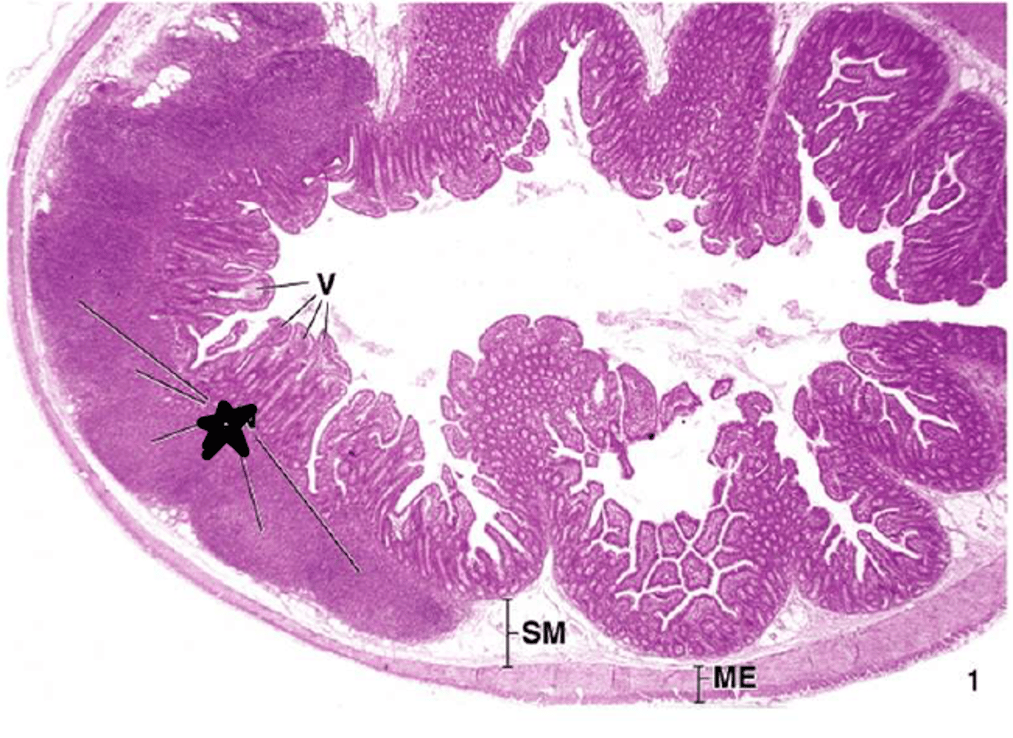 <p>ileum</p>
