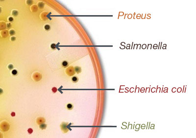 <ul><li><p>Selective for GNRs (very inhibitory, but other Enterics can grow) </p></li><li><p>Differentiates lactose fermenters and H<sub>2</sub>S producers </p></li></ul><p></p><p>Interpretation</p><ul><li><p>LF: pink colonies </p></li><li><p>NF: colorless colonies </p></li><li><p>H<sub>2</sub>S: black precipitate </p></li></ul><p></p>