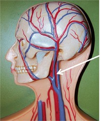 <p>wall of carotid arteries </p><p>aorta</p>