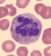 <p>What condition are these cells typically observed in?</p>