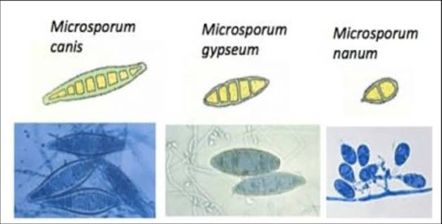 <p>Microsporum canis</p>
