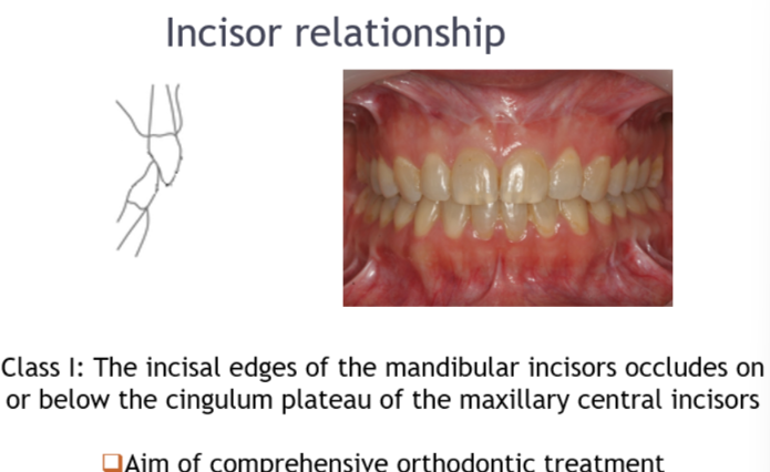 <p>Can use a mirror under the incisal edge to see this </p>