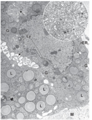 <p>What organelles are abundant in Leydig cells?</p>