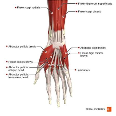 <p>flexor digiti minimi brevis</p>