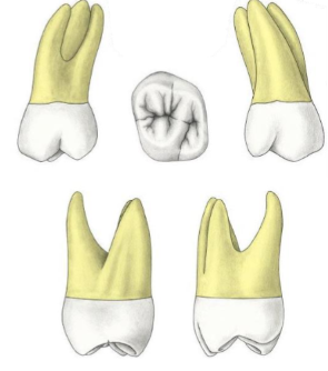 <p>Which tooth?</p>