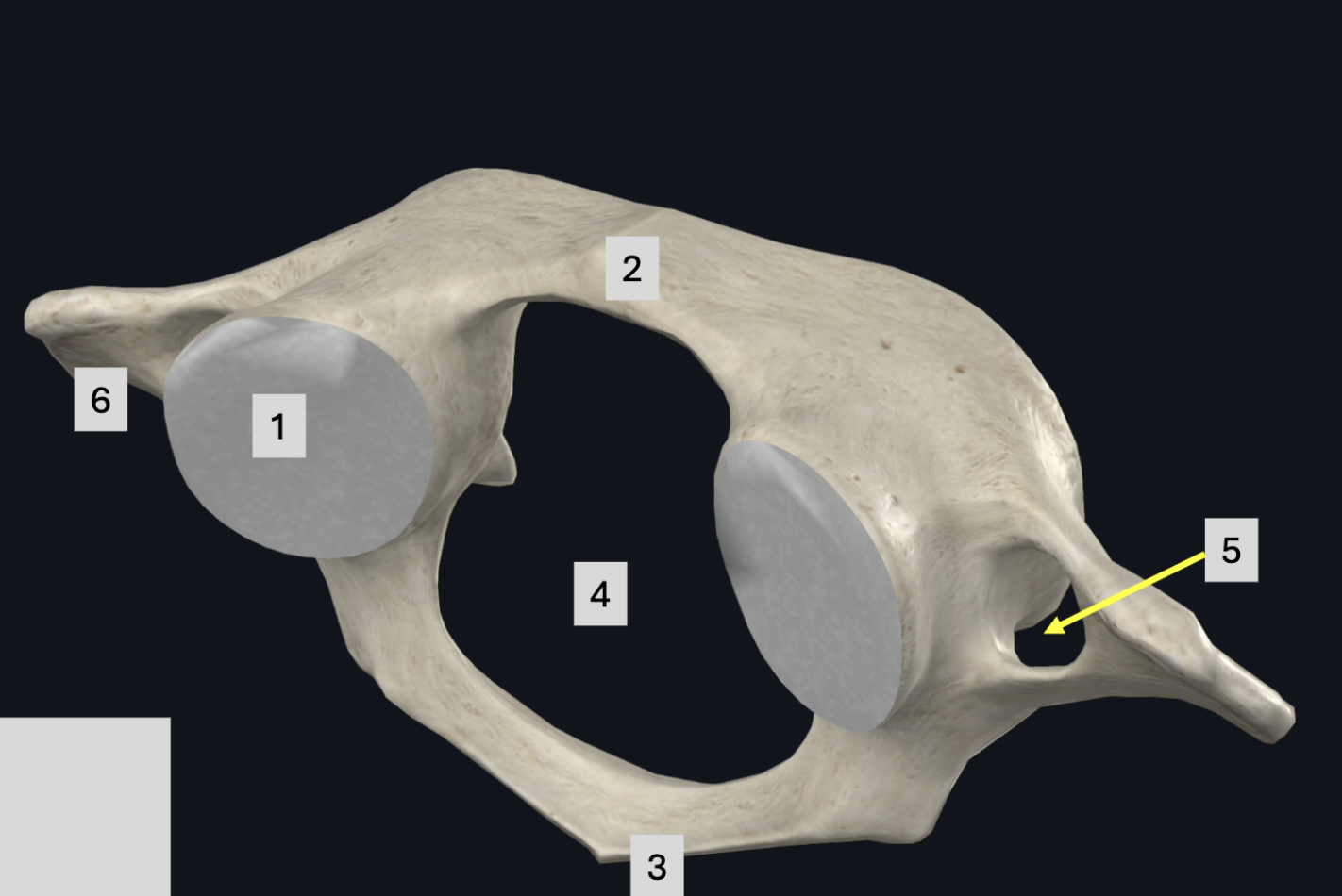 <p>Label each, what part of the spine is it? Be specific</p>