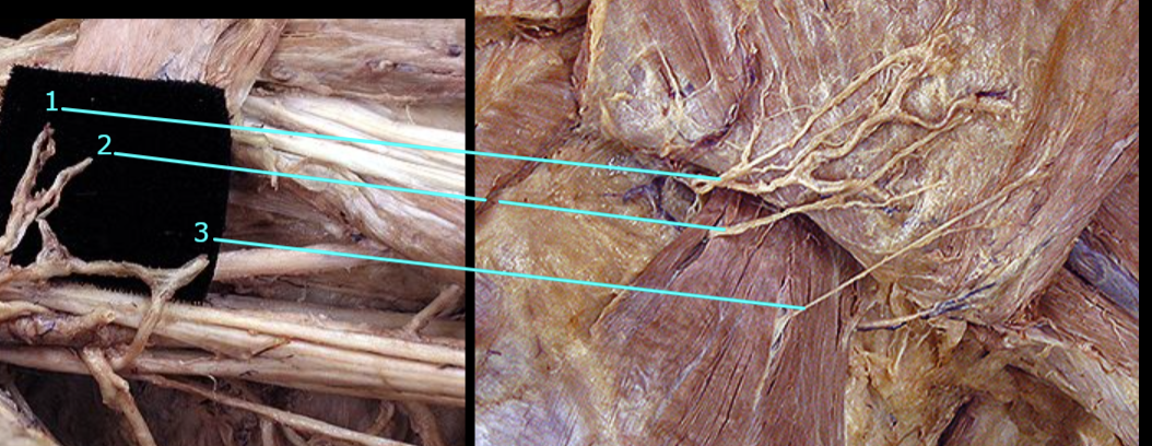 <p>Identify the nerve at 1</p>