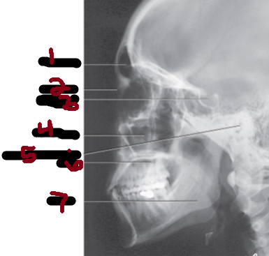 <p>7</p>