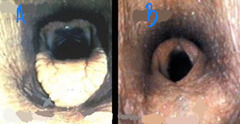 <p>Which of these images is normal? Which has an abnormality and what is it?</p>