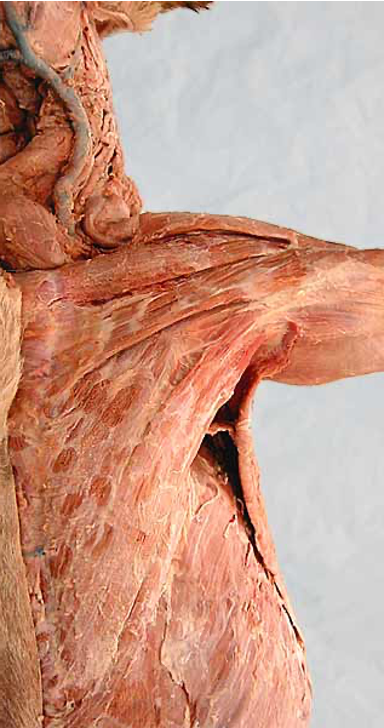 <p>name this muscle. what species is it?</p>