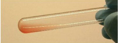 <p>no visible agglutination </p>