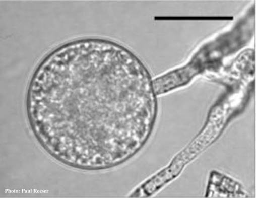 <p>a thick-walled, resiting spore</p>