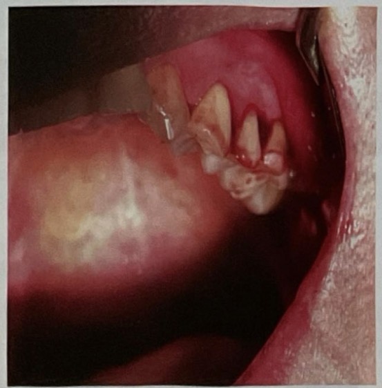 <p>CHẨN ĐOÁN?</p>