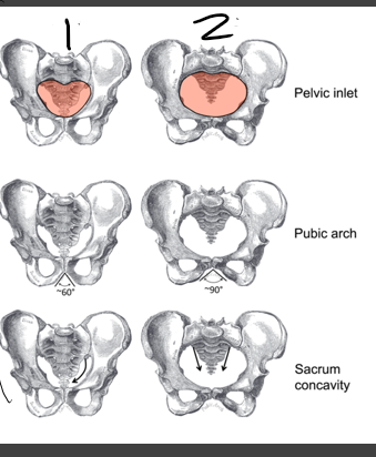 <p>which one is female?</p>