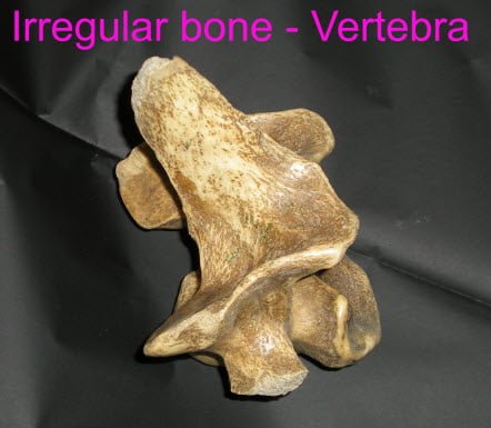 <p>Complicated shape. Ex: Vertebrae, facial bone, hip</p>