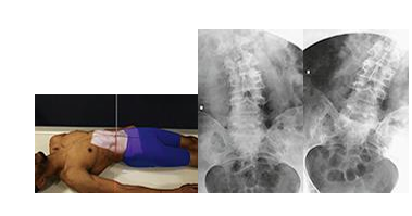 <p>what special view of the L-spine is this?</p>