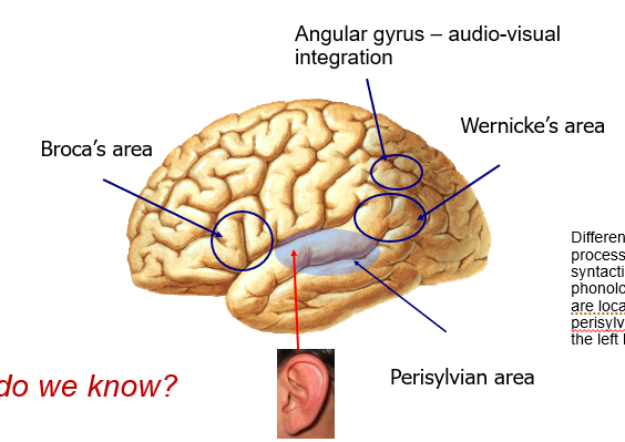 <ul><li><p><span style="font-family: "Arial Nova Light";">Language and the brain</span></p></li><li><p><span style="font-family: "Arial Nova Light";">Our very first understanding about the role of brain in language processing was back in 19thC, from Broca and Wernicke.</span></p></li><li><p><span style="font-family: "Arial Nova Light";">For the first time Broca and Wernicke identified specific parts of the brain responsible for different aspects of language processing.</span></p></li><li><p><span style="font-family: "Arial Nova Light";">We recognised </span><span style="background-color: rgb(255, 153, 204); font-family: "Arial Nova Light";">modularity</span><span style="font-family: "Arial Nova Light";"> of the brain through recognising language. This extended to other concepts that we recognised are organised, a brain area has a specific function, and is not just 'mush' in the brain. That different parts of the brain are responsible for different things.</span></p></li><li><p>Different linguistic processes such as lexical, syntactic and phonological processes are in perisylvian regions of left hemisphere.</p></li></ul><p></p>