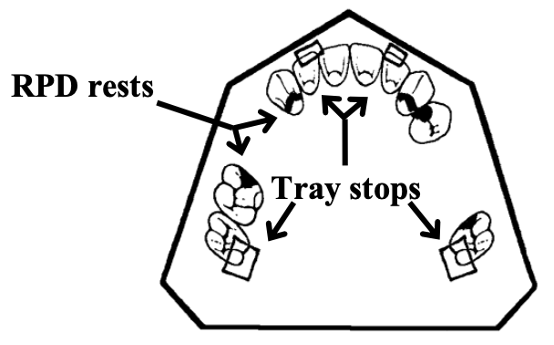 <p>Stops should be used whenever possible with acrylic resin final impression trays. How many stops are preferred?</p>