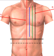 <p>(B)</p>